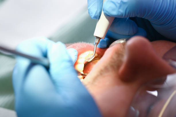 Best Weekend Emergency Dentist in Dellwood, MO