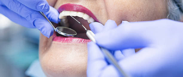 Best Urgent Care for Lost Fillings or Crowns in Dellwood, MO